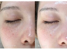 ウノ アッベリーナ(UNO × abbel'lina)の雰囲気(本気で肌質改善が叶う。かかりつけサロン#トロイアルケ#トーンup)