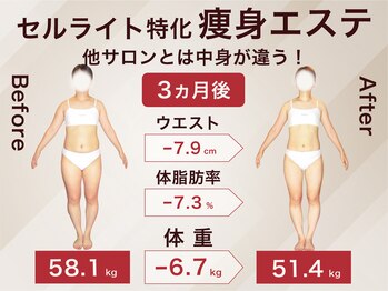 ラ パルレ 池袋本店/全身セルライトケア