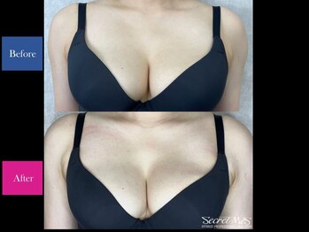 リアンの写真/【元町にある完全個室の隠れ家サロンで小顔施術とバストアップ◎】《新小顔術×バストケア》100分¥9,800