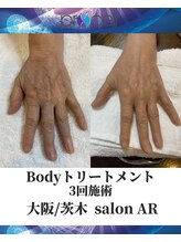 メンズサロンアール(AR)/プロセルセラピーズ