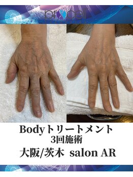 メンズサロンアール(AR)/プロセルセラピーズ