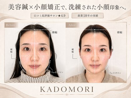 カドモリ 心斎橋(KADOMORI)の写真