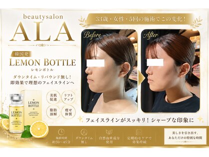 アーラ アンド べレア(ALA & Bellea)の写真