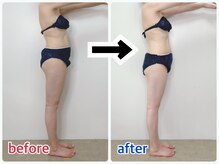 ルビーズ 柏店(RUBYZ)/ 1回の施術でボディラインが変化