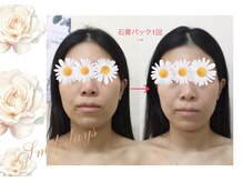 スマイルデイズ(Smiledays)/石こうパック