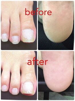 ネイルアンドアイラッシュヴィーナ ゆめタウン廿日市店 (Nail&EyeLash Vina)/足裏ツルツル角質除去