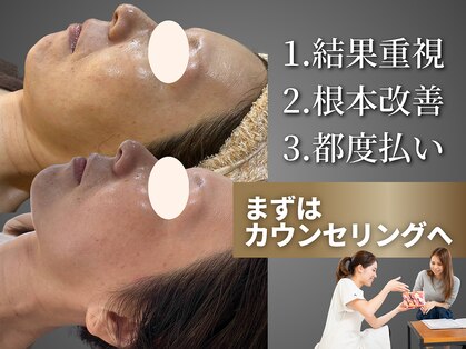 ミオ(MIO)の写真
