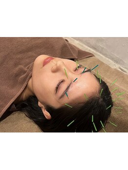 小顔になりたい