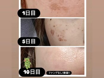 東洋経絡エステ アンド リラクゼーション/ファンデなし、すっぴん肌へ