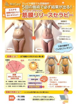 ルクソール/筋膜リリース