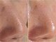 ルーモアンド(Lumo&)の写真/【春の毛穴・たるみ・シミ改善】乾燥で進む毛穴の開きやたるみ・くすみを集中ケア。透明感＆ハリ感アップ☆