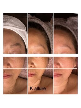 カリュール(K'allure)の写真/なんか顔が暗い…
春はくすみが出やすい季節です

