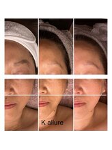 カリュール(K'allure)