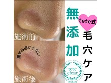 リル シャイン(Rill SHINE)/毛穴詰まりが綺麗に