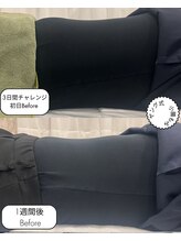 ネシア(nesia)/ヤング式小腸揉み（20分）