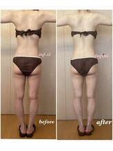 アンフィニ(infini)/短期集中全身5回コース（2ヶ月)