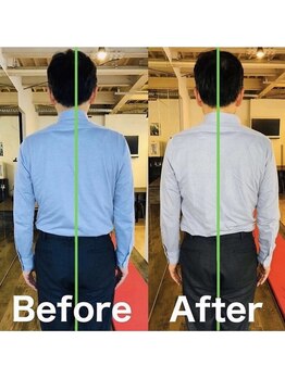 カワル整体 上通り院/デスクワークで左肩~肘が痺れる