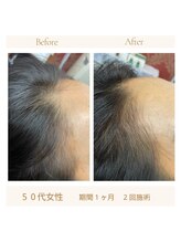 リリーボーテ 下北沢/まだ気になる程度のうちに！