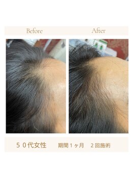 リリーボーテ 下北沢/まだ気になる程度のうちに！