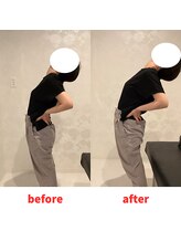 ナオル整体 福岡香椎院(NAORU整体)/40代女性施術事例【腰の痛み】