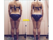 整体 美容サロン フェールラヴィ/【整体+痩身】