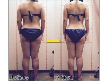 整体 美容サロン フェールラヴィ/【整体+痩身】