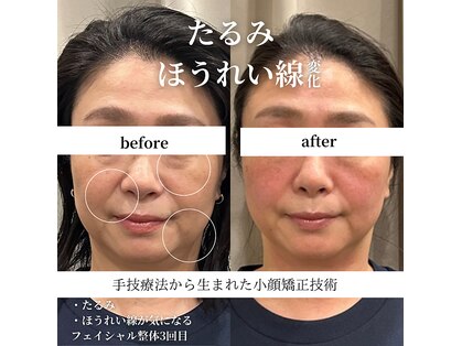 フェアリーフェイス 南森町店(Fairy Face)の写真