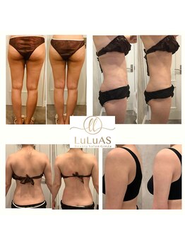 ルルアス 銀座(LuLuAS)/結果出し重視!!本格痩せ体質へ♪