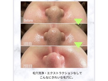 フレア(FULEA)/ラミネーションピール