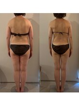 ラナ 京都西院店(Lana)/１年のビフォーアフター