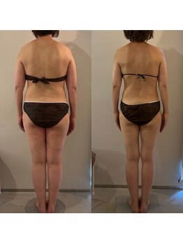 ラナ 京都西院店(Lana)/１年のビフォーアフター