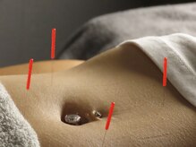 ビーネ 札幌琴似/ハリスリム 札幌琴似(Beene/Hari-Slim)の雰囲気（全国で活躍する美容鍼講師が運営・国内トップレベルの技術◎）