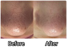 アミュレット(Amulette)/