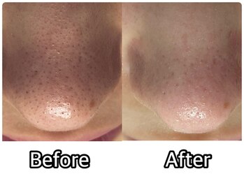 アミュレット(Amulette)/