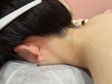 チュベルフェ(tu belle fe)/首が長く綺麗に見えるうなじ脱毛