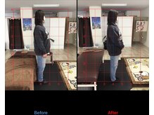 ストレチックス 近江八幡店/肩痛・姿勢改善ビフォーアフター