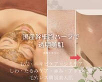 カラーリリー(calla lily)