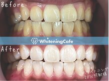 ホワイトニングカフェ 市川店(Whitening Cafe)の雰囲気（ホワイトニングを継続的な照射で理想な白さをGET☆）