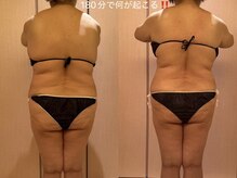 凪 横浜の雰囲気（自律神経バランスを整える肩首ラインから全身綺麗に１回）