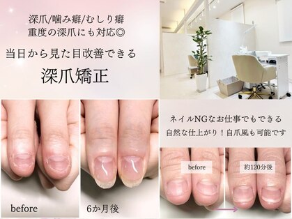 インブロッサム(imblossom)の写真
