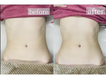 ボニービューティー(Bony Beauty)の写真/バストケアにプラス、くびれも欲しい★