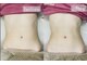 ボニービューティー(Bony Beauty)の写真/バストケアにプラス、くびれも欲しい★