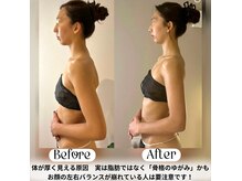 ソウ バイ ソウ(So by 蒼)の雰囲気（ブライダルエステ整体。巻き肩/顔の輪郭崩れ/たるみ/頬骨の突出）