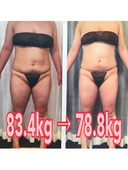 ボディエステティック アクアオーラ 富山店/８３．４ｋｇ　⇒　７８．８ｋｇ