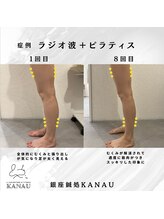 銀座鍼処 カナウ(KANAU)/美脚になれる方法あります♪