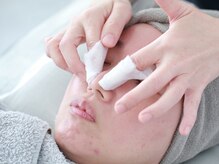 クレア(CLEA)/エクストラクション