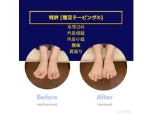 【事例はブログに詳細多数掲載】女性(24)外反/内反/腰痛/肩こり