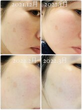 サロンプリア(salon plia)/