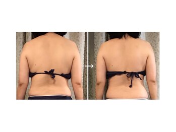 サロンドタエ(salon de TAE)/ビフォー＆アフター