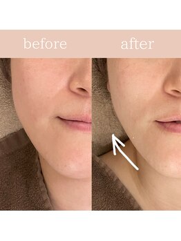 ハナワビューティーサロン(HanaWa beauty salon)/before&after